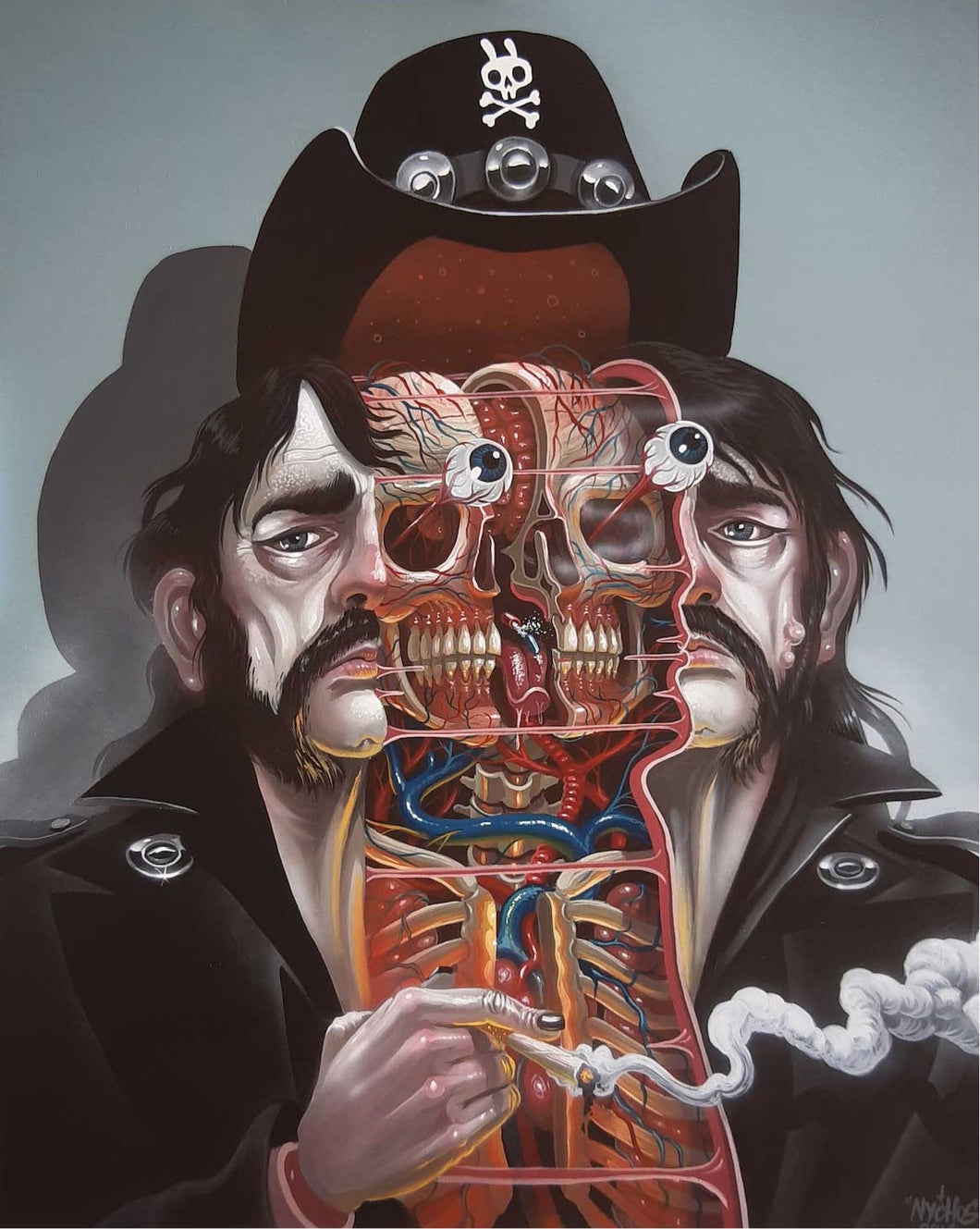 Nychos “Dissection Of Lemmy”